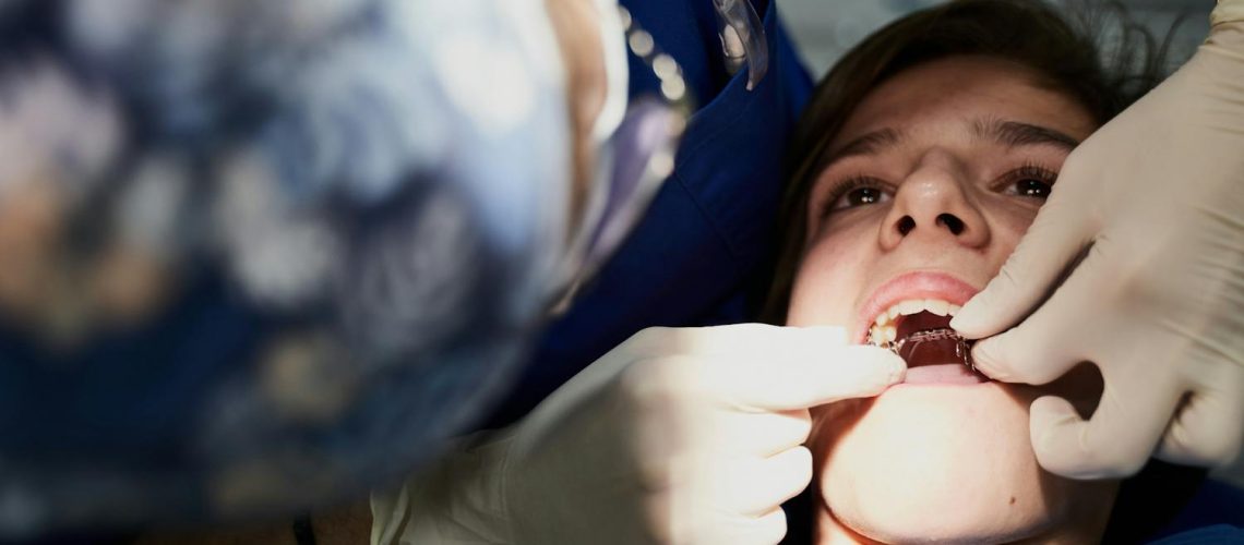 Bagues, gouttières, chirurgie… Comment aligner ses dents ?