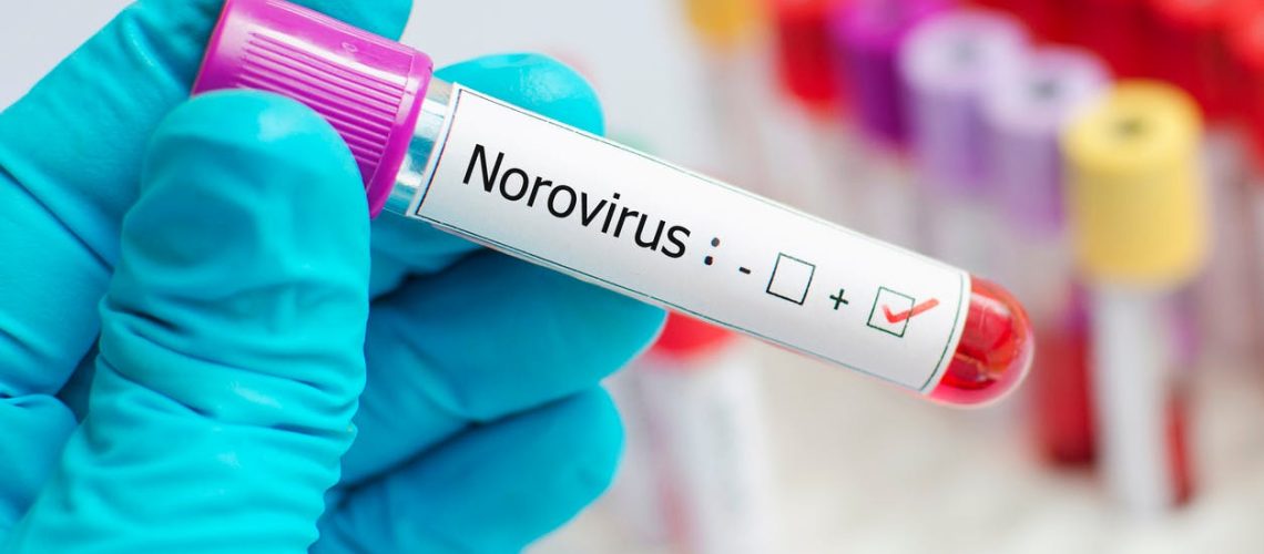 Comment éviter les infections à norovirus, responsables de gastro-entérites virales ?